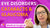 Med-Surg - Nervous System, part 14: Cataracts, Glaucoma - LevelUpRN