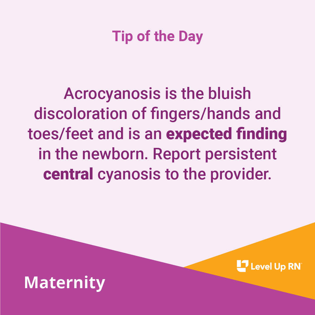 Acrocyanosis is the bluish discoloration of fingers/hands and toes/feet and is an expected finding in the newborn. Report persistent central cyanosis to the provider.
