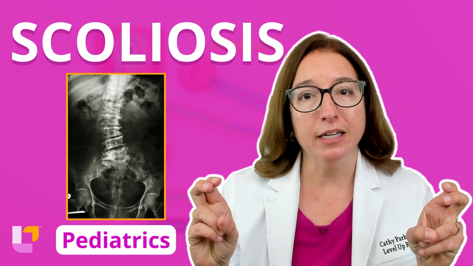 Peds, part 41: Musculoskeletal Disorders - Scoliosis - LevelUpRN